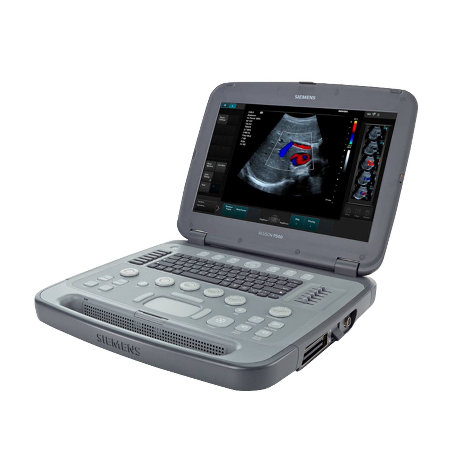 ACUSON P500 Ultrasound System