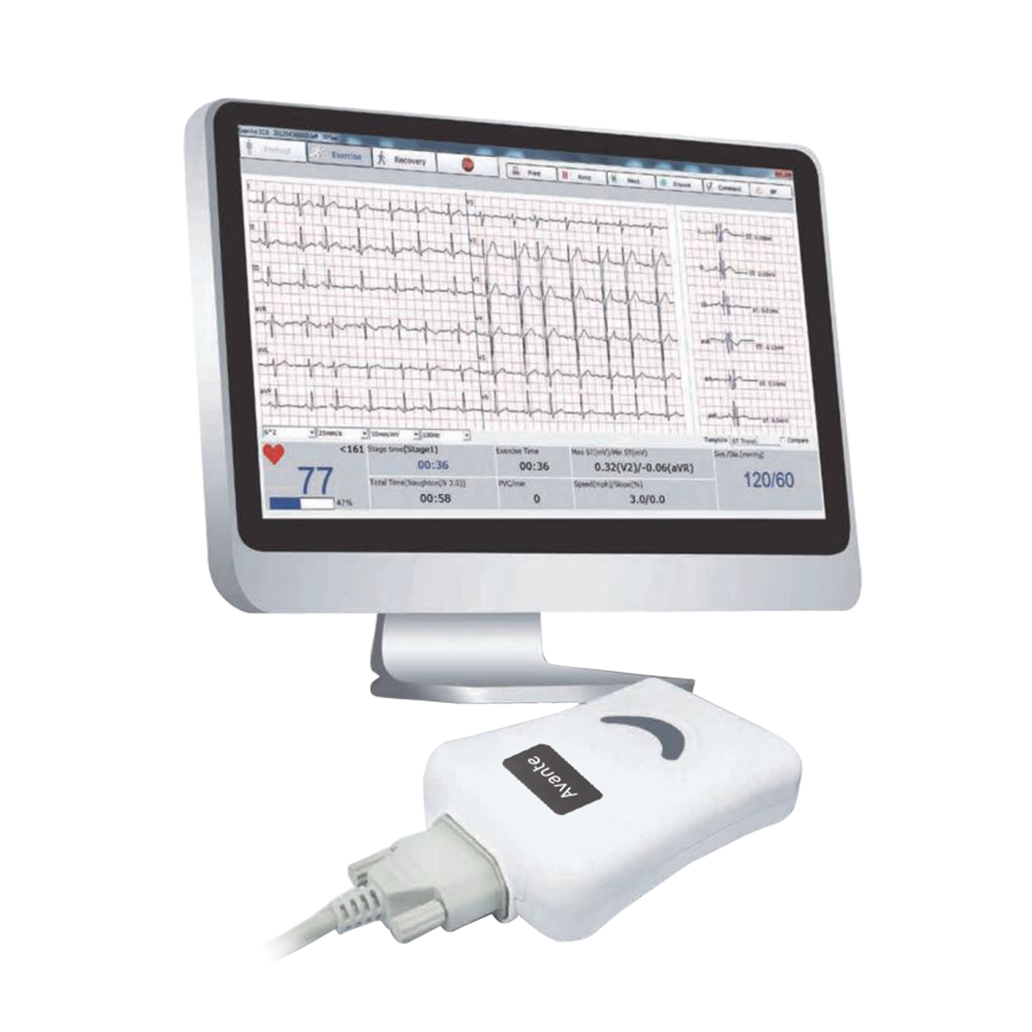 Med Vest Technology Velocity EKG 12-channel PC-based EKG